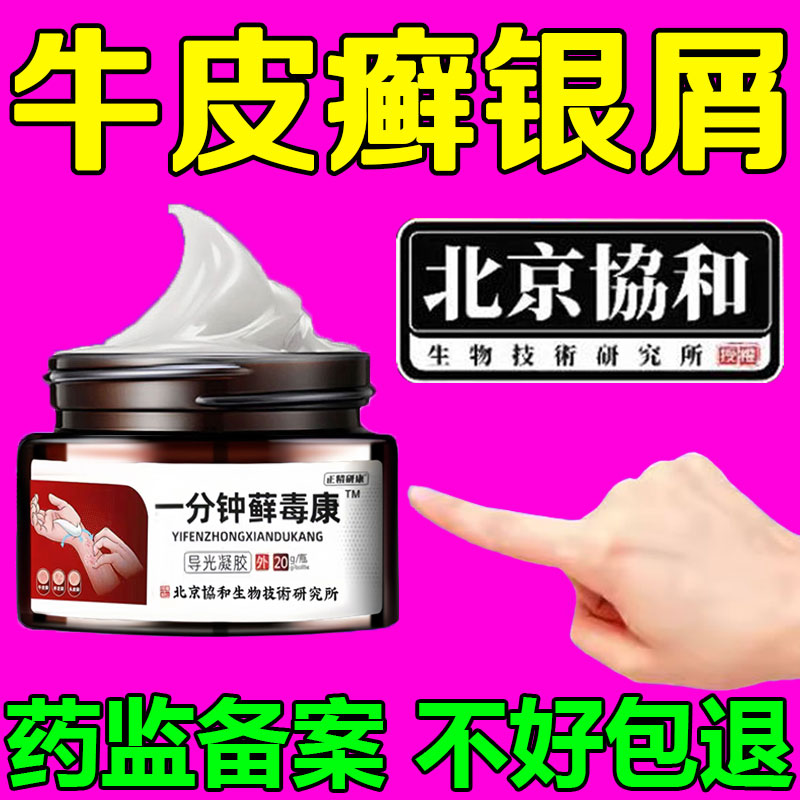 真菌感染药膏