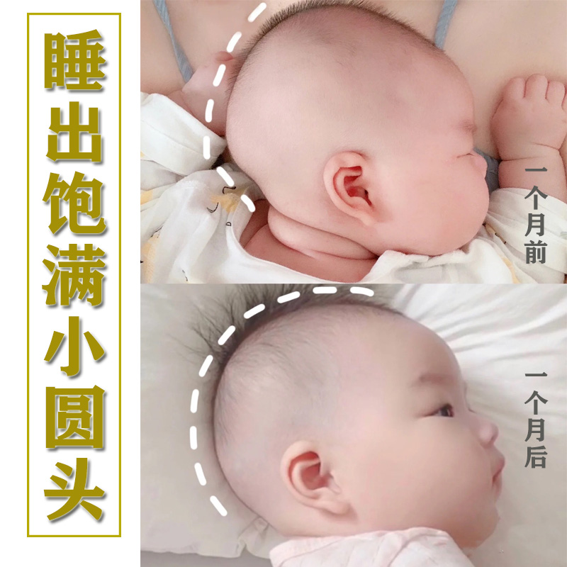 婴儿头型纠正定型枕