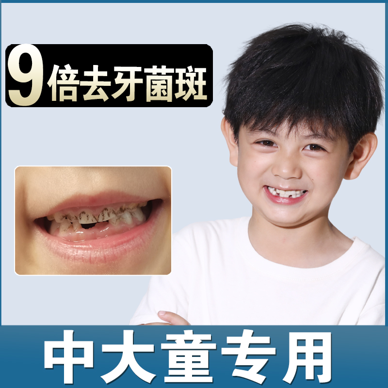 儿童牙膏防蛀牙黑牙